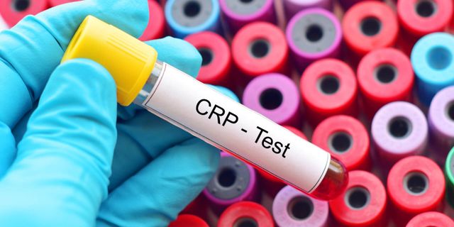 Crp Nedir? Crp Yüksekliği Neden Olur?