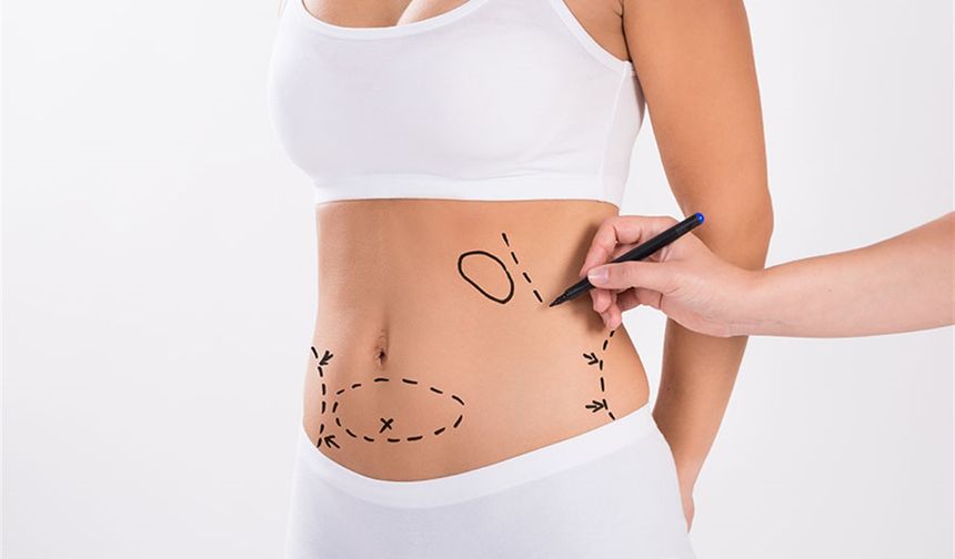 Liposuction ve Estetik Yöntemleri Nelerdir?